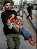 little girl wounded in gaza
